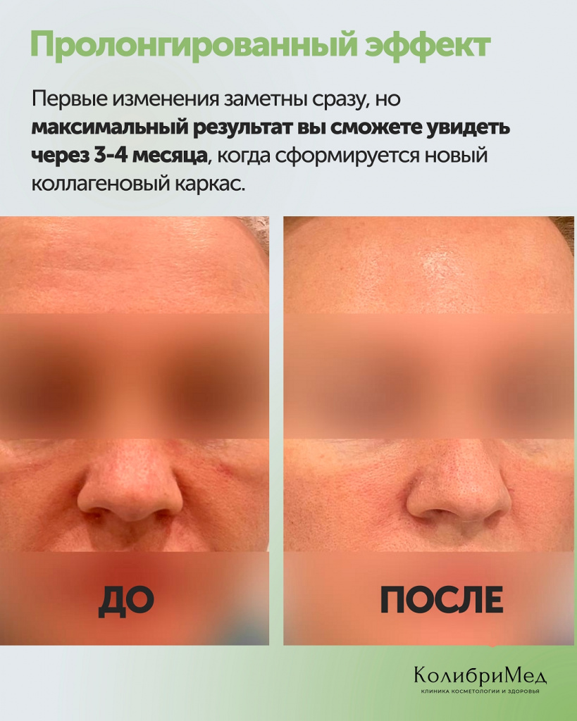 СМАС 3.jpg
